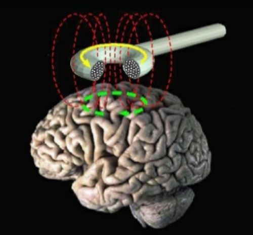 Transcranial Magnetic Stimulation